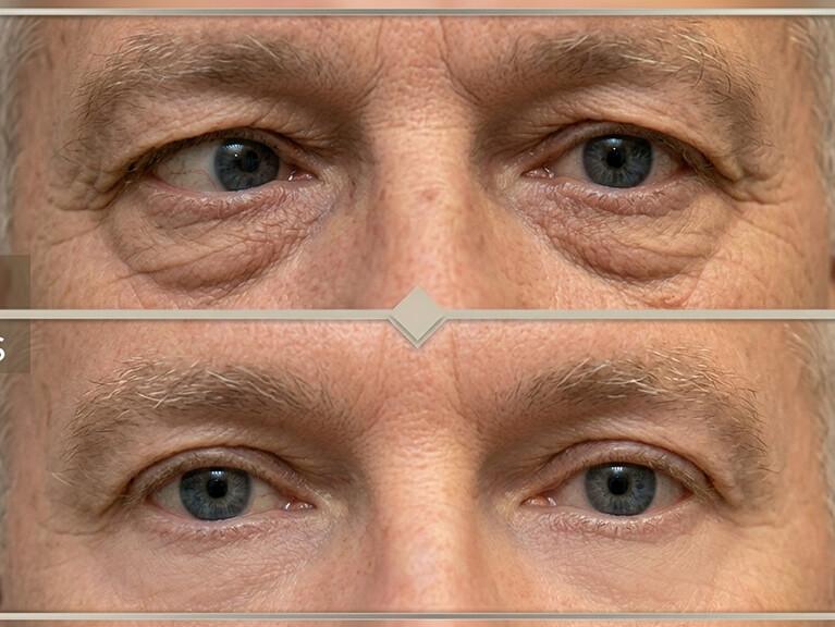 clinica de ojos ruiz montenegro services 1 otras especialidades estrabismo